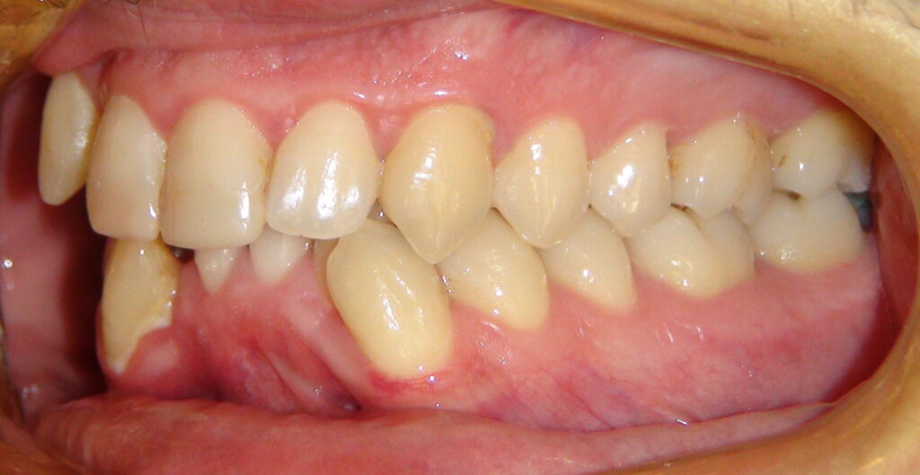 DSC02518